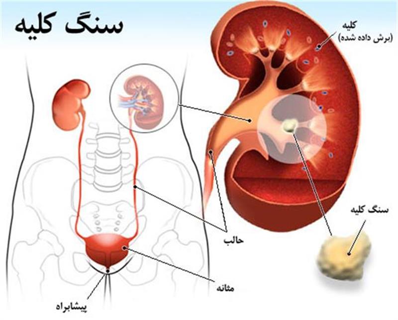 دکتر کلیه و مجاری ادراری اردبیل