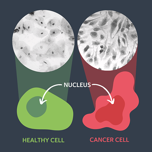 سلول های سرطانی و سلول های طبیعی