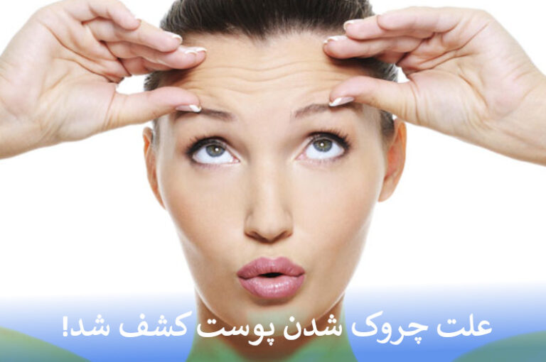چروک شدن پوست