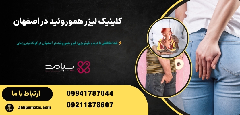 لیزر هموروئید در اصفهان