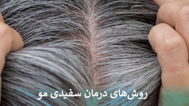 درمان سفیدی مو