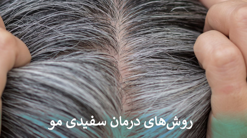 درمان سفیدی مو