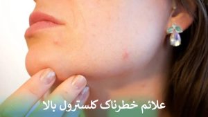 علائم خطرناک کلسترول بالا