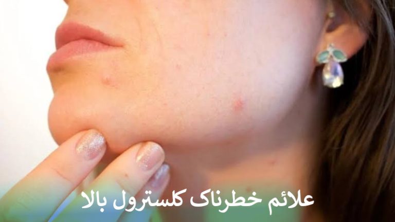 علائم خطرناک کلسترول بالا