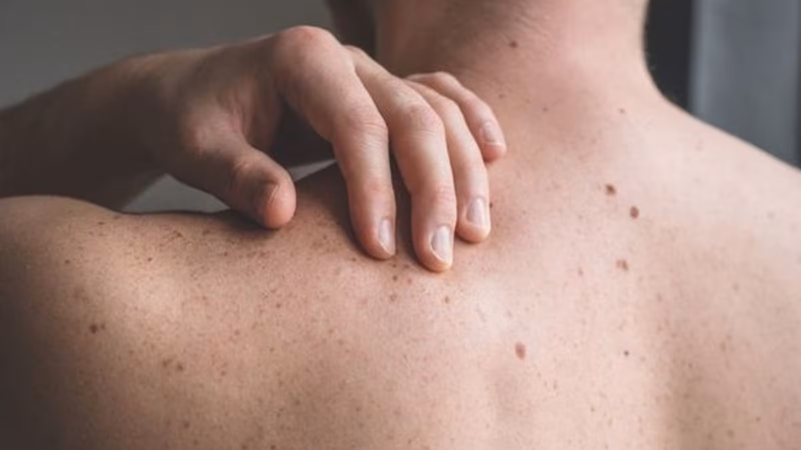 علائم خطرناک کلسترول بالا