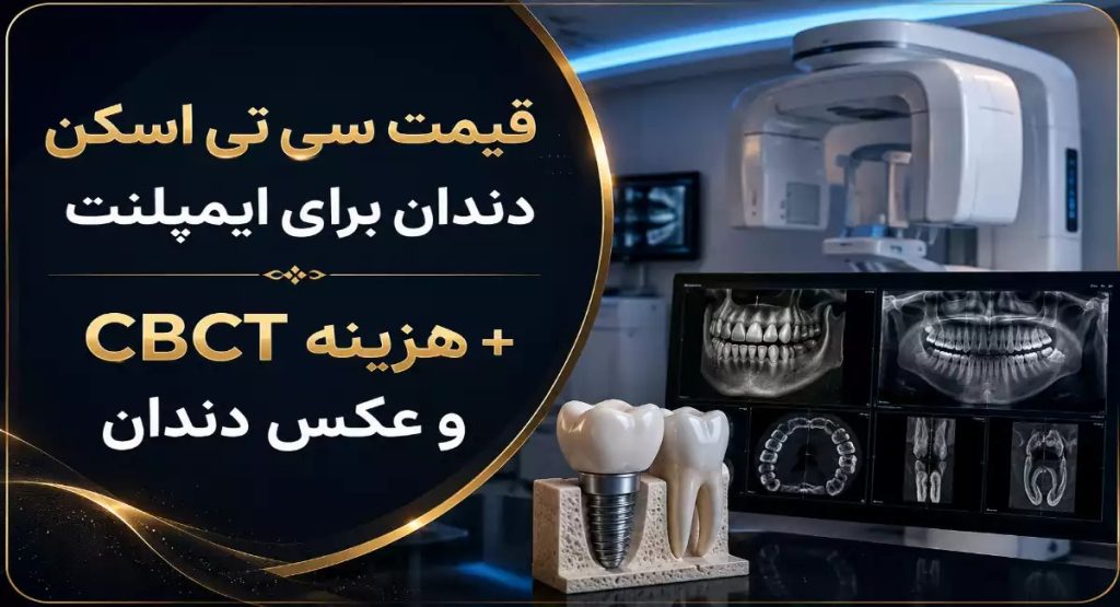 هزینه سی تی اسکن دندان برای ایمپلنت (CBCT) در سال 1405
