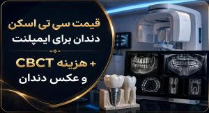 هزینه سی تی ‌اسکن دندان برای ایمپلنت (CBCT) در سال 1405