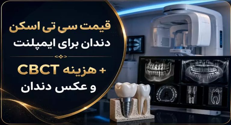 هزینه سی تی ‌اسکن دندان برای ایمپلنت (CBCT) در سال 1405