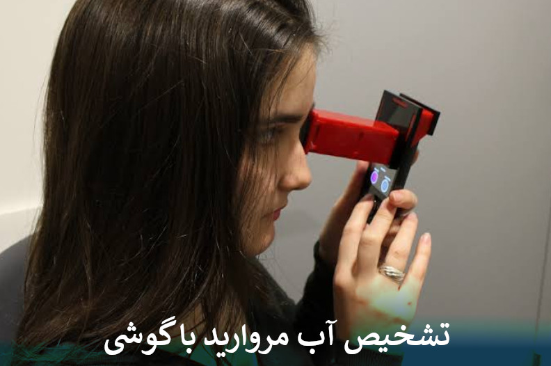 تشخیص آب مروارید با گوشی